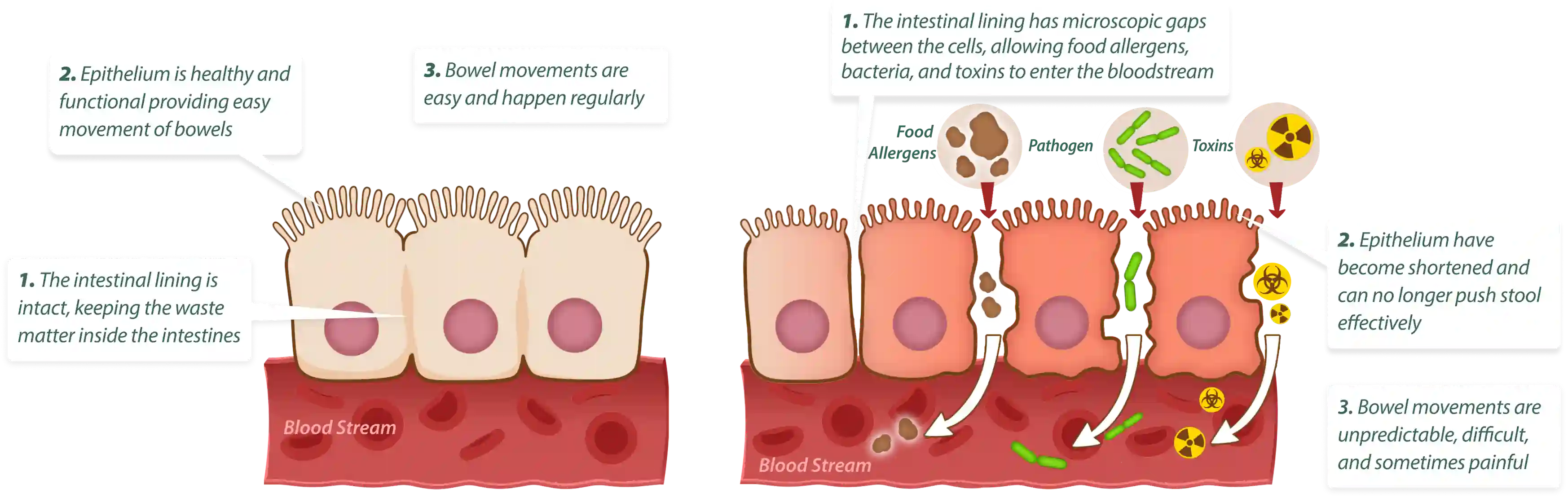 How EmmaRelief works – 3-step gut cleansing and healing process