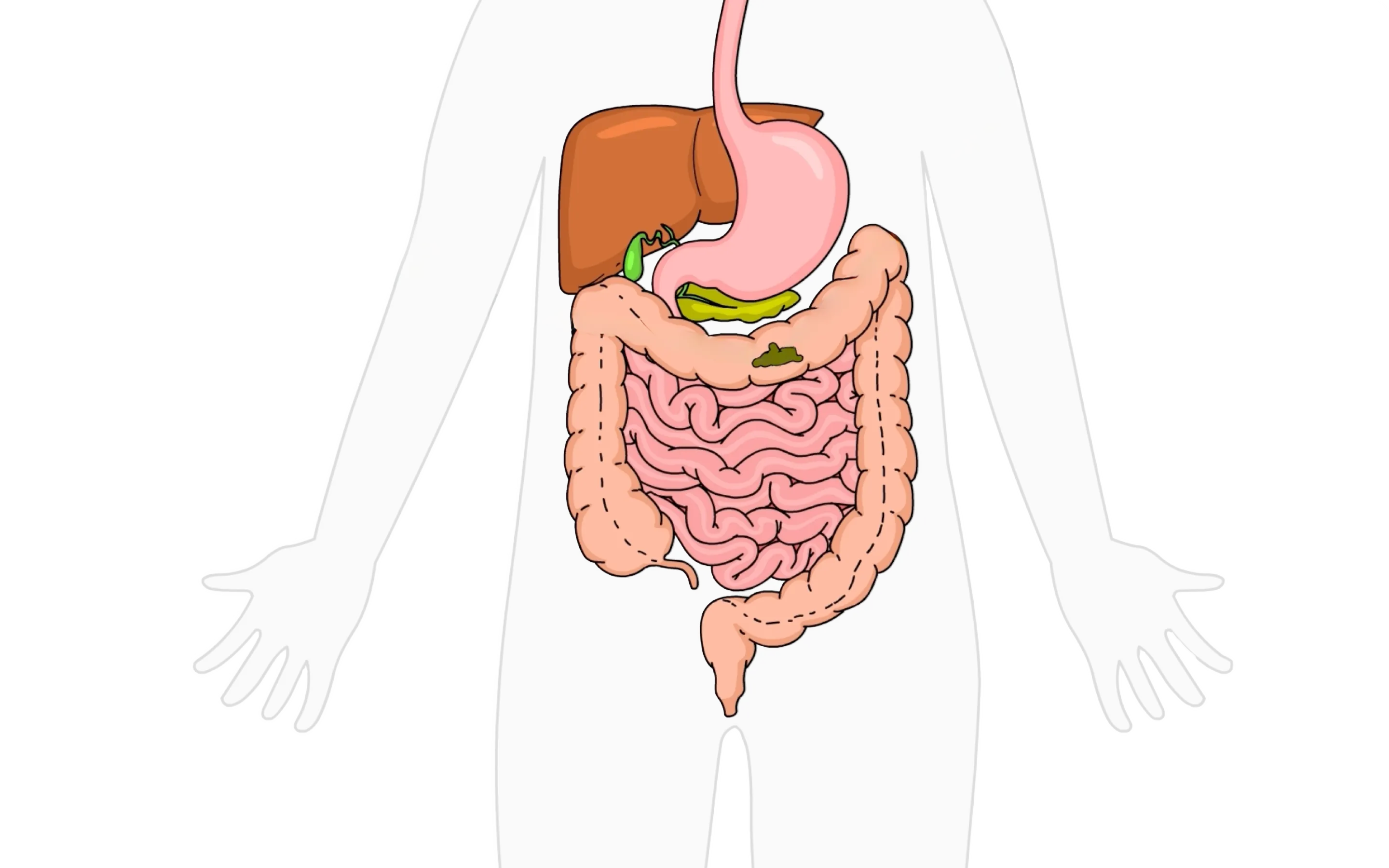 EmmaRelief gut health video illustration
