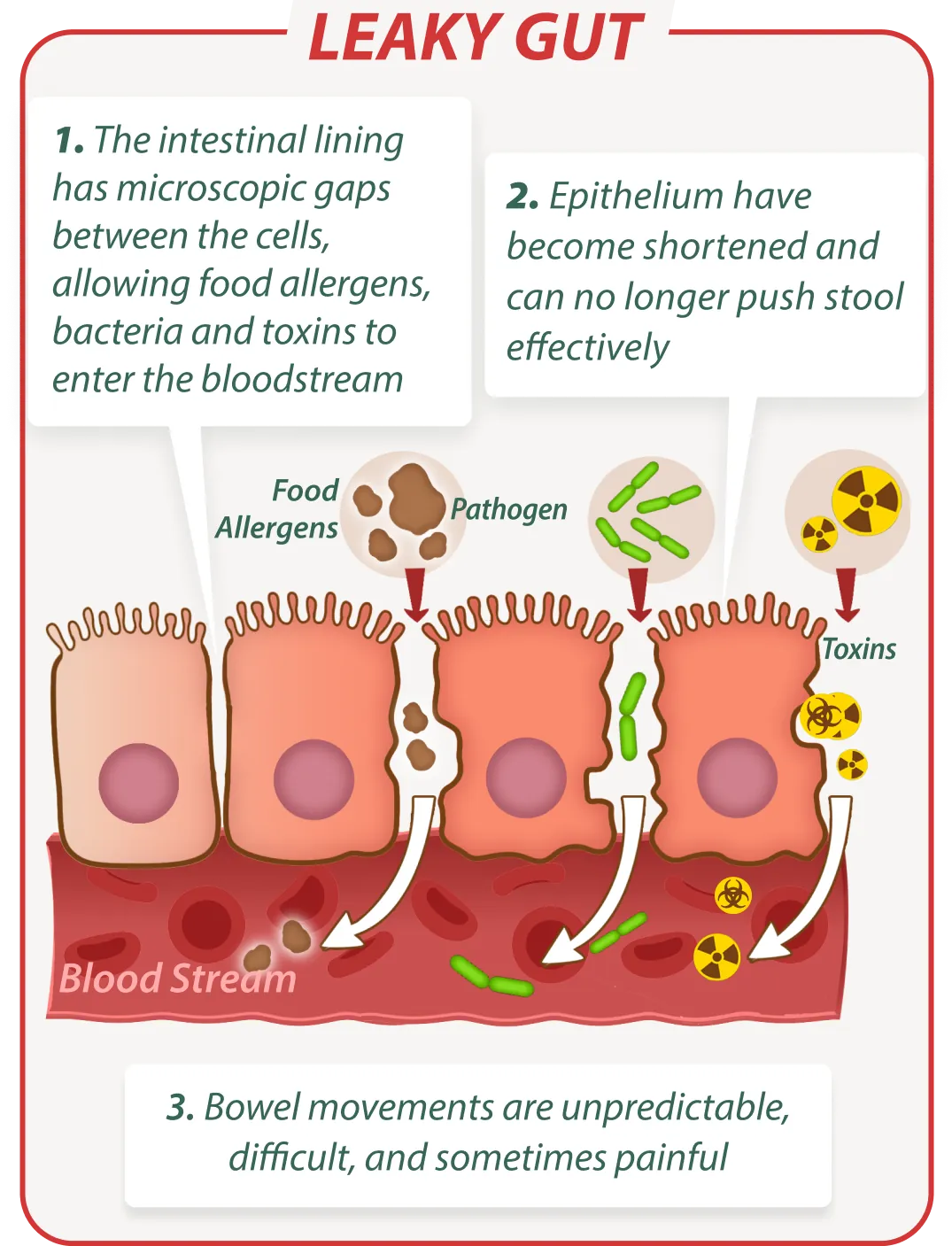 Leaky gut without EmmaRelief – digestive issues illustration